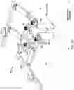 Fig. 14 - Cervical retractor and method