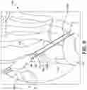 Fig. 07 - Surgical system and methods for stabilization and fixation of fractures, joints, and reconstructions