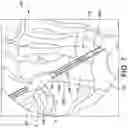 Fig. 08 - Surgical system and methods for stabilization and fixation of fractures, joints, and reconstructions