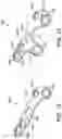 Fig. 11 - Surgical system and methods for stabilization and fixation of fractures, joints, and reconstructions
