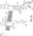 Fig. 14 - Surgical system and methods for stabilization and fixation of fractures, joints, and reconstructions