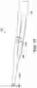 Fig. 15 - Surgical system and methods for stabilization and fixation of fractures, joints, and reconstructions