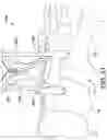 Fig. 19 - Surgical system and methods for stabilization and fixation of fractures, joints, and reconstructions
