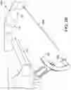 Fig. 24 - Surgical system and methods for stabilization and fixation of fractures, joints, and reconstructions