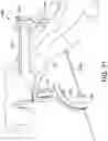 Fig. 25 - Surgical system and methods for stabilization and fixation of fractures, joints, and reconstructions
