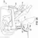 Fig. 26 - Surgical system and methods for stabilization and fixation of fractures, joints, and reconstructions