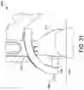 Fig. 29 - Surgical system and methods for stabilization and fixation of fractures, joints, and reconstructions