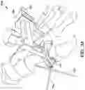 Fig. 32 - Surgical system and methods for stabilization and fixation of fractures, joints, and reconstructions