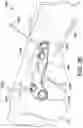 Fig. 33 - Surgical system and methods for stabilization and fixation of fractures, joints, and reconstructions