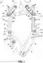 Fig. 02 - Self-retaining retractor