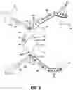 Fig. 04 - Self-retaining retractor