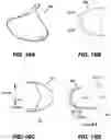 Fig. 19 - Self-retaining retractor