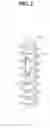 Fig. 03 - Perforator-integral suture anchor device