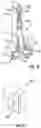 Fig. 16 - Orthopedic staple insertion