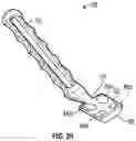 Fig. 17 - Orthopedic staple insertion