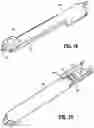 Fig. 11 - Anvil buttress attachment for surgical stapling apparatus