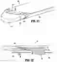 Fig. 17 - Anvil buttress attachment for surgical stapling apparatus