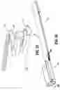 Fig. 20 - Anvil buttress attachment for surgical stapling apparatus
