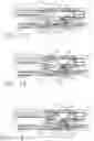 Fig. 09 - Surgical stapler knife motion controls