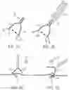 Fig. 02 - Clip for endoscope