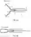 Fig. 07 - Clip for endoscope