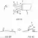 Fig. 12 - Clip for endoscope