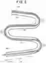 Fig. 03 - PULL WIRE DETACHMENT FOR INTRAVASCULAR DEVICES