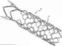 Fig. 01 - METHODS AND DEVICES FOR TREATMENT OF VASCULAR DEFECTS