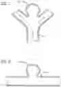 Fig. 02 - METHODS AND DEVICES FOR TREATMENT OF VASCULAR DEFECTS