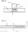 Fig. 10 - METHODS AND DEVICES FOR TREATMENT OF VASCULAR DEFECTS