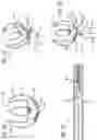 Fig. 17 - METHODS AND DEVICES FOR TREATMENT OF VASCULAR DEFECTS