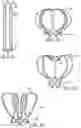 Fig. 21 - METHODS AND DEVICES FOR TREATMENT OF VASCULAR DEFECTS