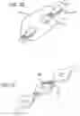 Fig. 29 - METHODS AND DEVICES FOR TREATMENT OF VASCULAR DEFECTS