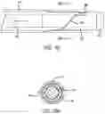 Fig. 34 - METHODS AND DEVICES FOR TREATMENT OF VASCULAR DEFECTS