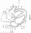 Fig. 02 - LEFT ATRIAL APPENDAGE CLOSURE IMPLANT