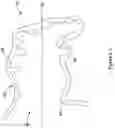 Fig. 03 - LEFT ATRIAL APPENDAGE CLOSURE IMPLANT