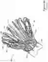 Fig. 07 - LEFT ATRIAL APPENDAGE CLOSURE IMPLANT