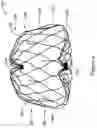 Fig. 10 - LEFT ATRIAL APPENDAGE CLOSURE IMPLANT