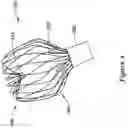 Fig. 13 - LEFT ATRIAL APPENDAGE CLOSURE IMPLANT