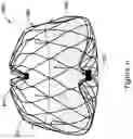 Fig. 17 - LEFT ATRIAL APPENDAGE CLOSURE IMPLANT