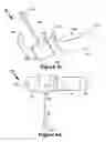 Fig. 12 - Balloon assembly for use in a hemostasis band