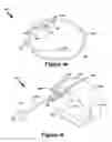 Fig. 13 - Balloon assembly for use in a hemostasis band