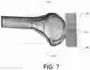Fig. 08 - Adjustable cutting guide apparatus for use in orthopedic surgery