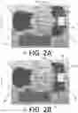 Fig. 03 - Patella resection guide with independent adjustment