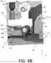 Fig. 09 - Patella resection guide with independent adjustment