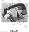 Fig. 15 - Patella resection guide with independent adjustment
