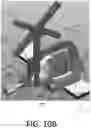 Fig. 19 - Patella resection guide with independent adjustment
