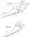 Fig. 07 - APPARATUS FOR REMOVING A HOOK WITH A BARB