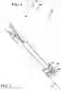 Fig. 04 - Advanced minimally invasive multi-functional robotic surgical devices and methods
