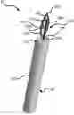 Fig. 01 - Micro-invasive surgical device and methods of use